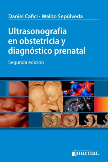 Ultrasonografía En Obstetricia Y Diagnóstico Prenatal