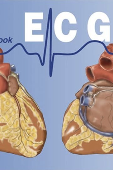 Vélez Ecg Handbook