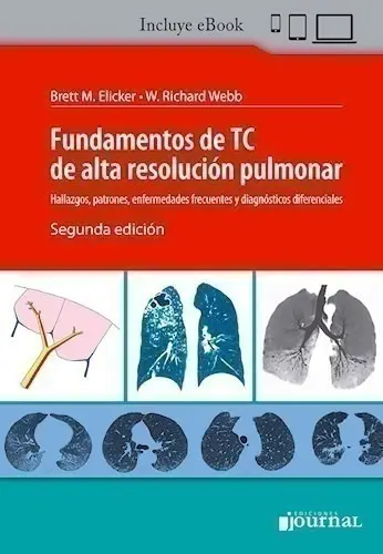 Fundamentos De Tc De Alta Resolucion Pulmonar - Webb