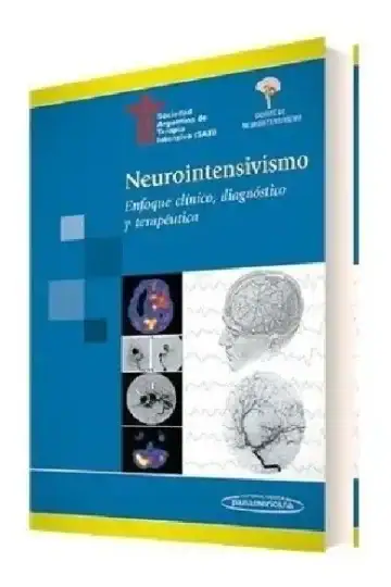 Neurointensivismo Enfoque Clinico Diagnostico Y Terapeutico